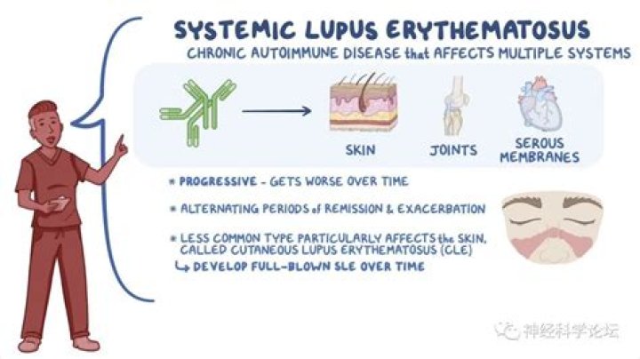 Understanding Lupus And The Promise Of Ozempic: A Comprehensive Guide